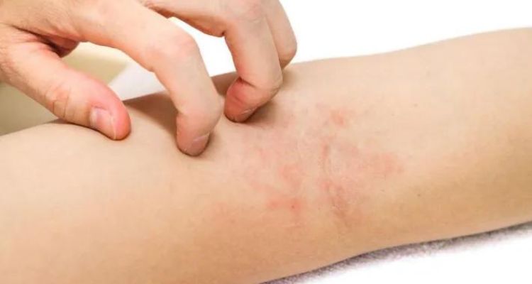 Health Effects of Fiberglass